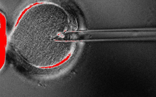 In this undated photo provided by OHSU Center for Embryonic Cell and Gene Therapy, scientists use a pipette to remove the nucleus from an egg. Britain's fertility regulator has approved controversial techniques allowing doctors to create babies using DNA from three people — what it called a "historic" decision to help prevent a small number of children from inheriting potentially fatal diseases from their mothers.