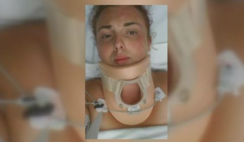 Dakota Kern was treated for injuries she received after being attacked by a group of up to 20 people. Dakota Kern transgender assault