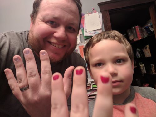 Dad and son show off their nail polish. Dad and son show off their nail polish.