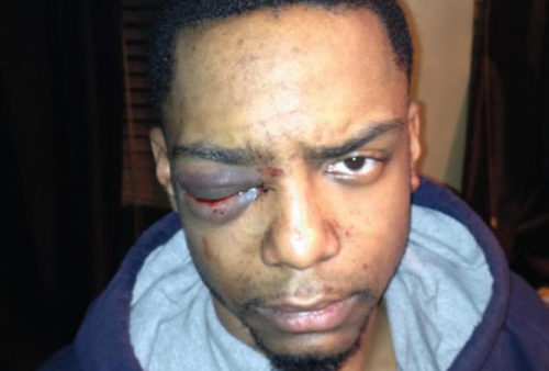 Taj Patterson, in a photo taken shortly after the December 2013 attack. taj-patterson
