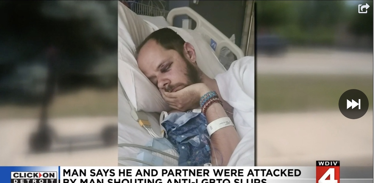 Thug shouting slurs fractures gay man’s skull as his partner screams for help