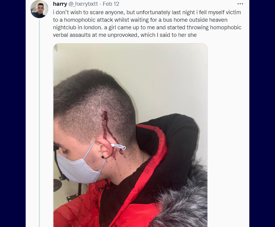 Student left bleeding after random stranger punches him while shouting anti-gay slurs
